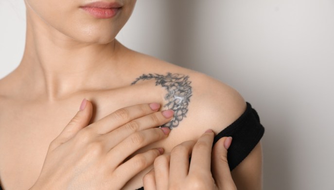 Come cancellare i tatuaggi