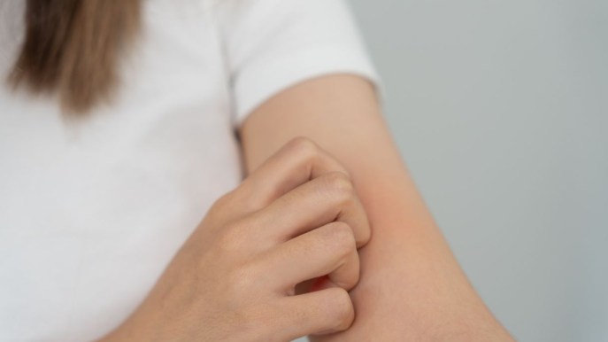 Il virus Zika: cos’è, da dove arriva e come si manifesta