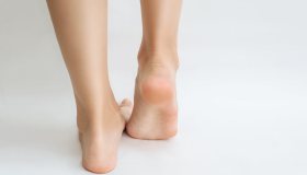 Running: come prevenire le vesciche ai piedi