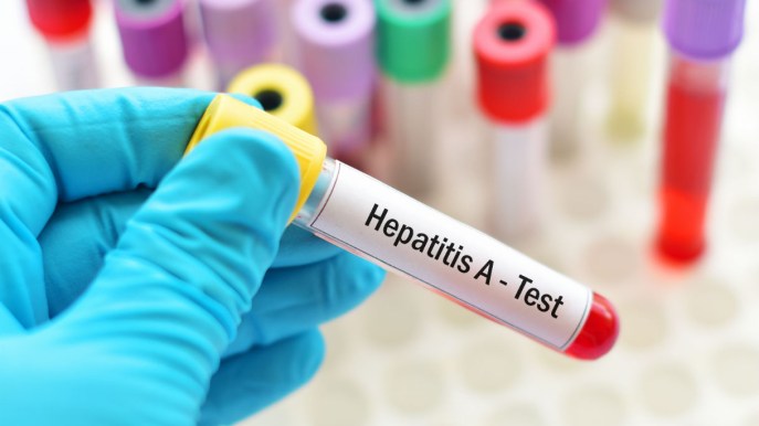 Epatite A: sintomi, cause, vaccino e prevenzione