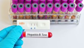 Epatite B: sintomi, cause, vaccino e prevenzione