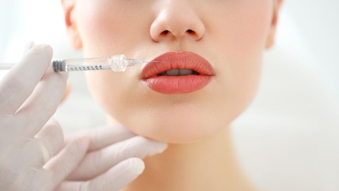 Filler labbra: tutto quello che devi sapere sul trattamento estetico più richiesto
