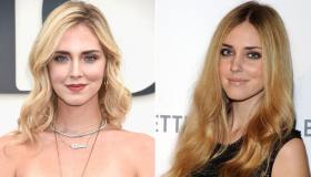 I ritocchini di Chiara Ferragni: parla il chirurgo dei vip