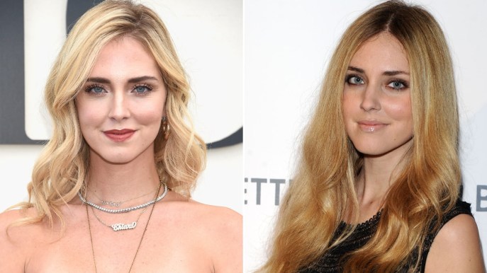 I ritocchini di Chiara Ferragni: parla il chirurgo dei vip