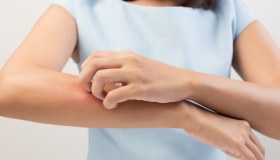 Psoriasi: le patologie correlate che potrebbero svilupparsi