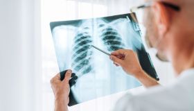 Tubercolosi: cos’è, sintomi e trattamenti