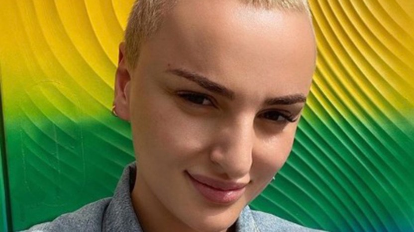 Arisa svela la sua malattia: perché è costretta a portare i capelli corti