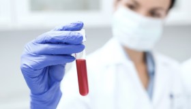 Piastrinopenia: cos’è, come si riconosce e perché si sviluppa