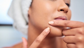 L’ittiolo fa davvero scomparire i brufoli? Cos’è e come usarlo in sicurezza