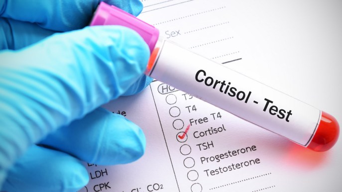 Cushing, come riconoscere la malattia del volto a “luna piena”