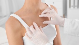 Come prevenire il rischio melanoma: prendere il Sole con giudizio