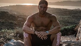 Giornata Mondiale della vitiligine, Luca Onestini: “Mi amo così”