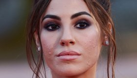 Venezia, Giulia De Lellis diva con l’acne: lezione di #skinpositive