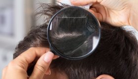 Pidocchi: come riconoscerli e cosa fare per eliminarli