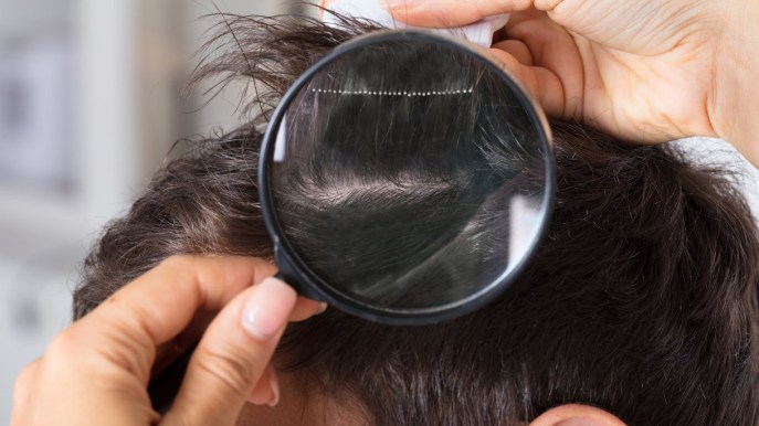 Pidocchi: come riconoscerli e cosa fare per eliminarli