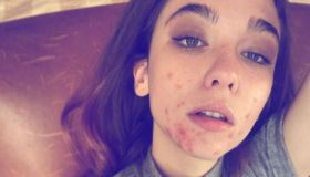 Matilda De Angelis su Instagram mostra il viso senza trucco: “Per accettarmi”