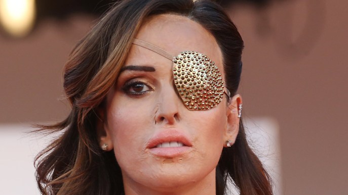 Gessica Notaro, la gioia su Instagram: “Ricomincia a comparire il mio vero volto”