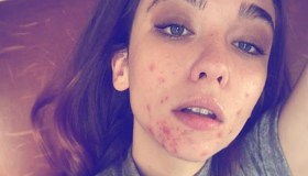 Matilda De Angelis: “Fiera delle mie cicatrici. Non mi importa essere bella”