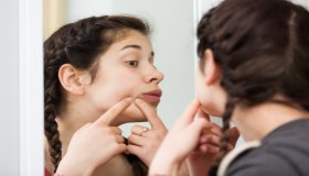 Acne giovanile: cosa fare?