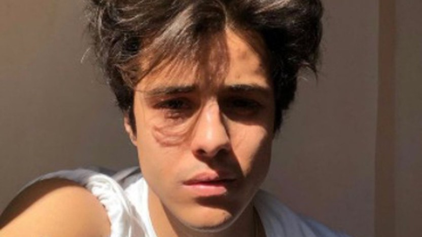 Michele Merlo, parla il medico che l’ha respinto: il dolore dei genitori