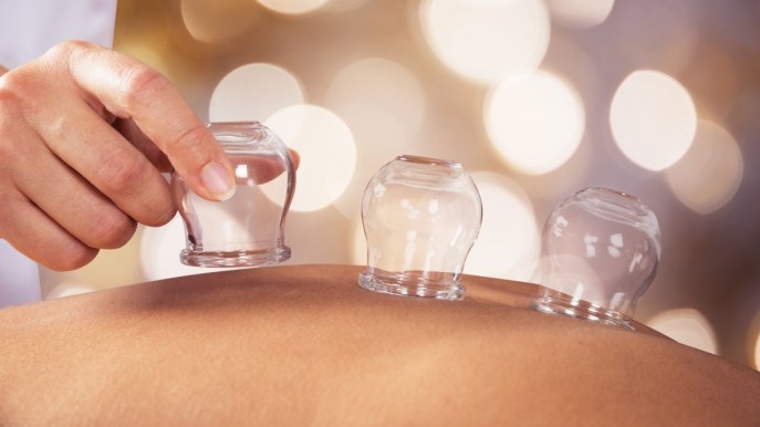 Coppettazione: cos’è e a cosa serve