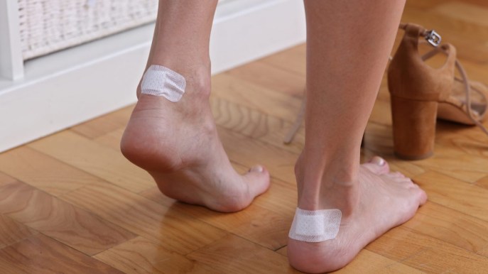 Vesciche ai piedi: cause e rimedi