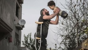 L’amore nella disabilità: la foto che vince (e insegna) tutto