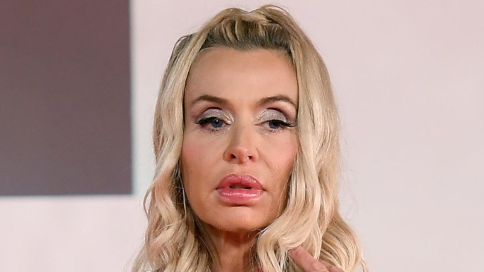 Valeria Marini operata a Roma: come sta adesso