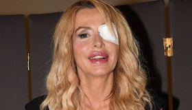 Valeria Marini, perché in tv ha l’occhio bendato