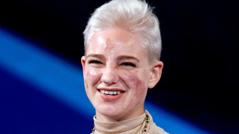 Le Iene, Bebe Vio campionessa di sogni: la sorpresa a Francesca che fa sognare