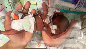 Quando è nato pesava 420 grammi. Oggi è un bimbo sano e bellissimo