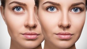 Zoom Face, perché non sopportiamo più i difetti del volto. Parla il dr. Santanchè