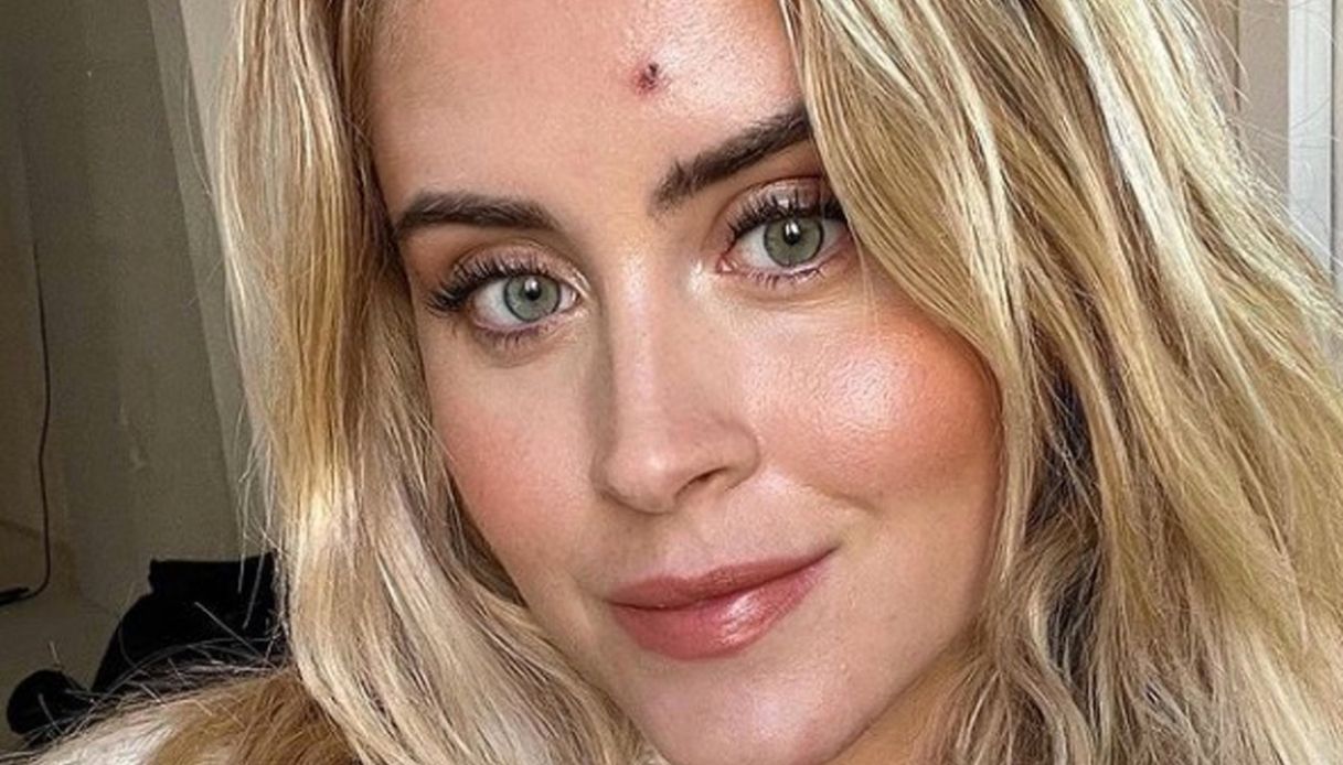 Verissimo, Valentina Ferragni: “Sono guarita da un tumore maligno”