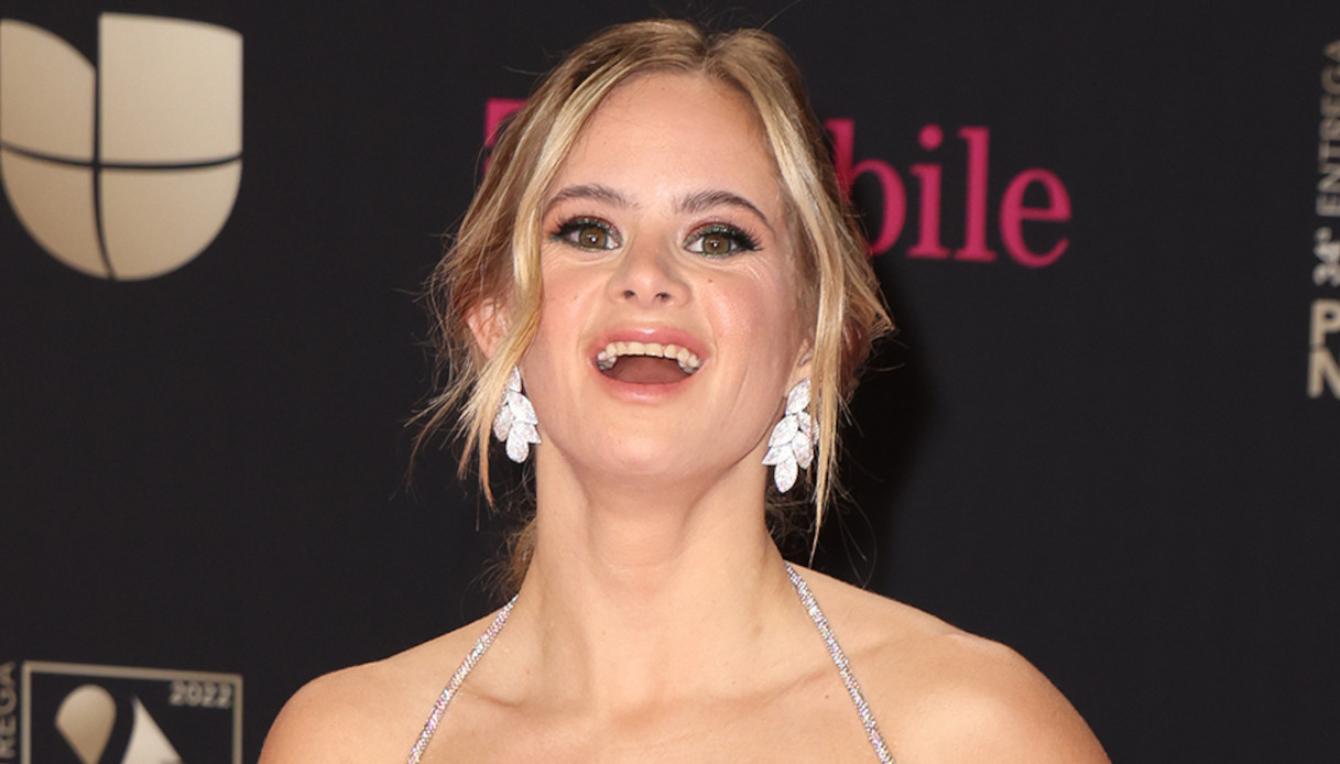 Sofìa Jirau, chi è la prima modella di Victoria’s Secret con la sindrome di Down