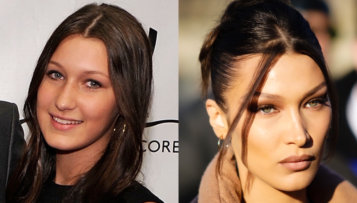 Bella Hadid, i primi ritocchi estetici a 14 anni (di cui oggi si pente)