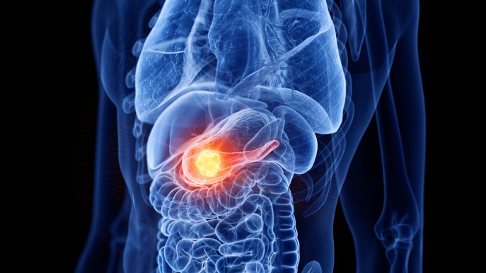 Tumori neuroendocrini: cosa sono, come si riconoscono e si affrontano