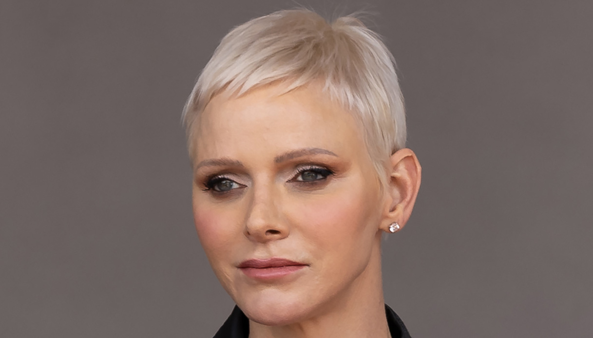 “Charlene di Monaco sfigurata”: la verità sull’intervento chirurgico