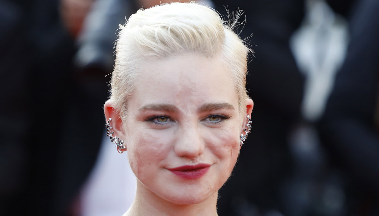 Bebe Vio, la fenice che rinasce: è un simbolo per tutte noi