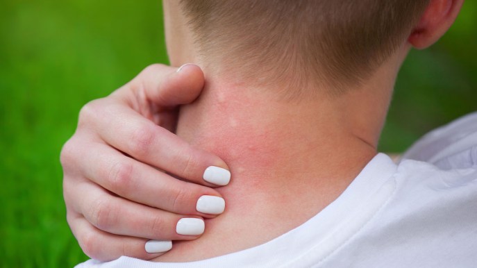 Virus del Nilo Occidentale, 10 cose che bisogna sapere