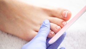 Unghie, non solo micosi: ecco i segnali cui fare attenzione