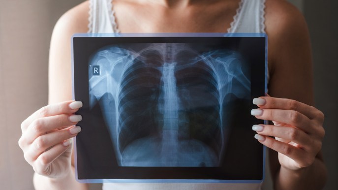 Tumore polmonare, perché chi fuma è a rischio e come scoprirlo presto