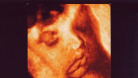 Ecografia 3D e 4D in gravidanza: differenze, quando farle e a chi rivolgersi