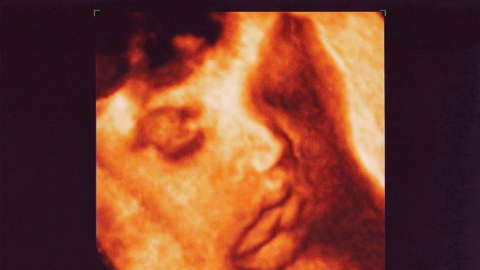 Ecografia 3D e 4D in gravidanza: differenze, quando farle e a chi rivolgersi