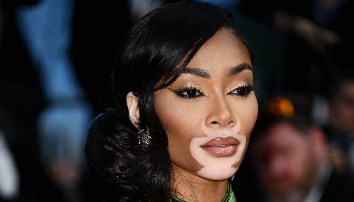 La top model con la vitiligine lascia senza fiato a Cannes