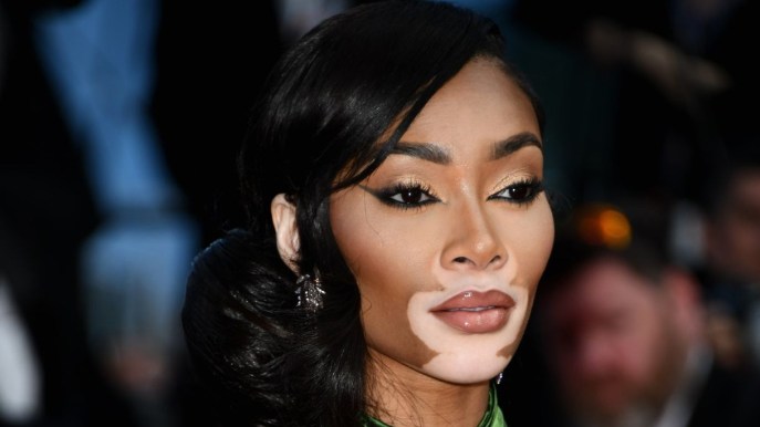 La top model con la vitiligine lascia senza fiato a Cannes