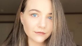 Dopo tre figli con la sindrome di Down scopre di averla anche lei: la storia