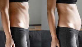 Diastasi addominale, patologia sottovalutata che cambia la vita