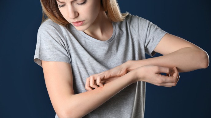 Psoriasi, come si vive con la malattia: lo studio