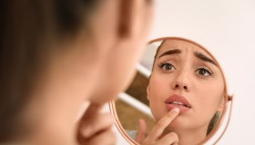 Angioedema, non allergia: cos’è, come si riconosce e si affronta