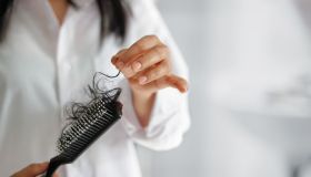 Caduta dei capelli: cause, rimedi e prevenzione